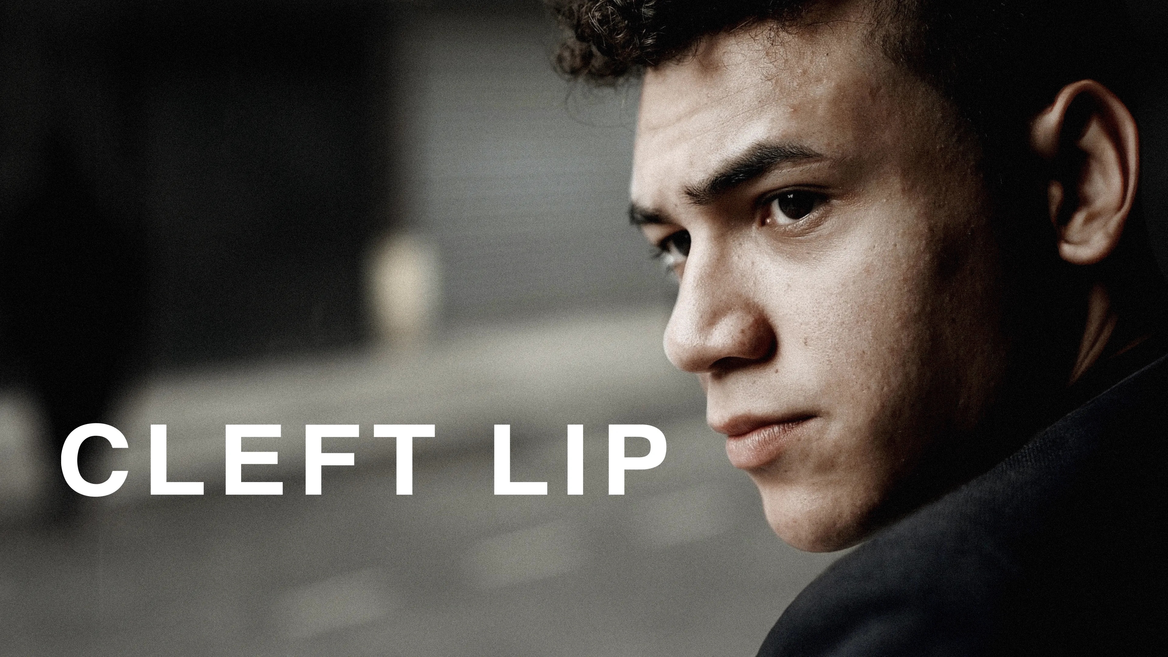 Cleft Lip (2019)